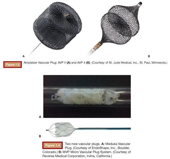 栓塞剂简史和分类开云 开云体育官网(图4)